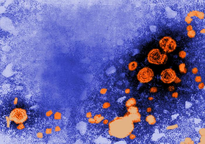 Hepatitídy A, B, C, D, E: Čo by mal vedieť dnešný pacient.